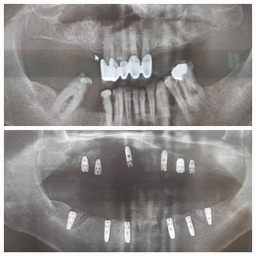 Slider image (8) Prestij Dental Clinic